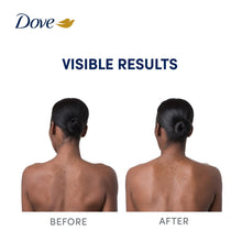 Load image into Gallery viewer, Dove Niacinamide Even Tone Body Serum 200ml 6 Pack, Vitamin C for Dark Spots