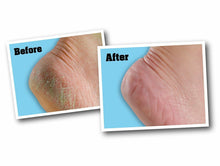 Load image into Gallery viewer, O&#39;Keefe&#39;s Healthy Feet Relief for Dry Feet That Crack And Split - 85g or 91g